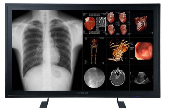 圖 1:8MP 56 寸醫(yī)用遠(yuǎn)距會診多任務(wù)影像顯示大屏